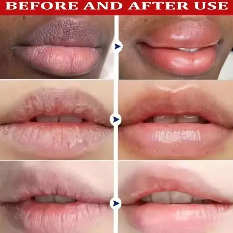 Ohmistry MelaLight™ Melanin-Correcting & Radiance Lip Treatment Balm - Image 3