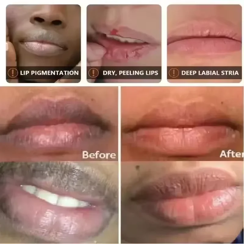 Ohmistry MelaLight™ Melanin-Correcting & Radiance Lip Treatment Balm - Image 2